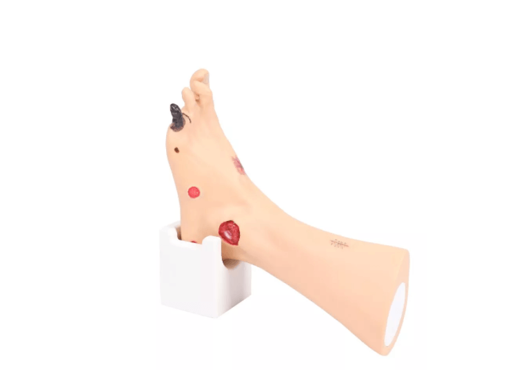 Wanda Wundenfuß – Fußmodell zur Wundversorgung & Diagnoseschulung - Erler - Zimmer